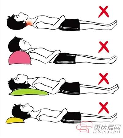 23岁男子10年不睡枕头颈椎严重变形